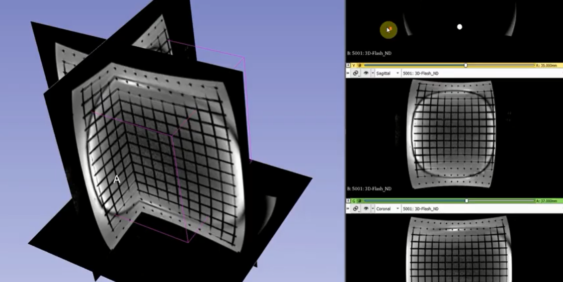 黃金標準X射線乳腺攝影對比度細節模體CDMAM 3.4